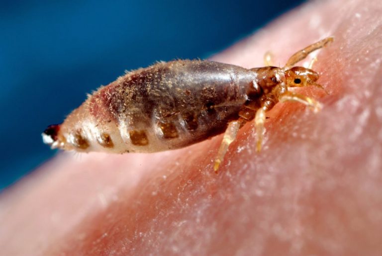 what do lice eat