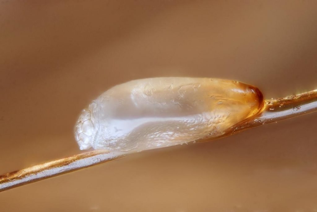 How long do lice live?
